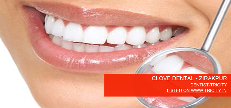 CLOVE-DENTAL---ZIRAKPUR