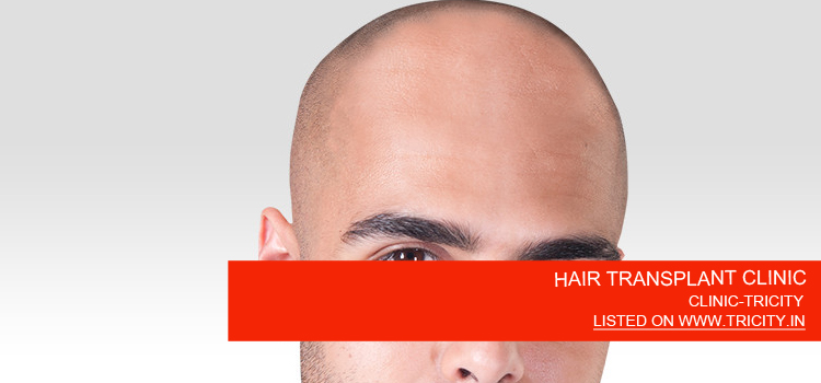 HAIR TRANSPLANT CLINIC