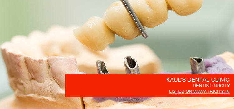 KAUL'S DENTAL CLINIC