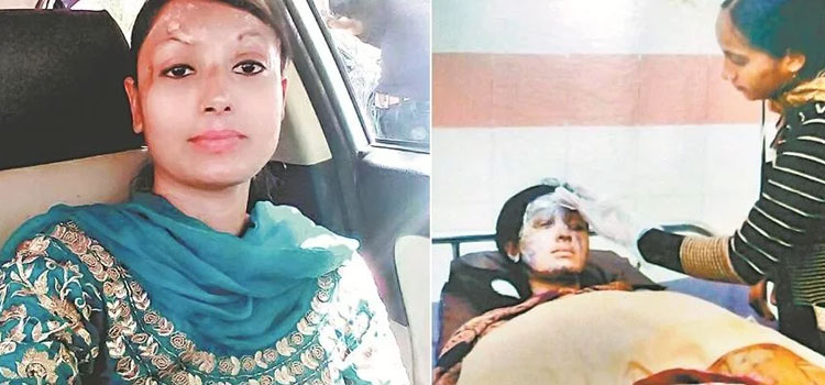 तीन दिन पूछती रहीं, मेरा मूंह तां नईं खराब होया