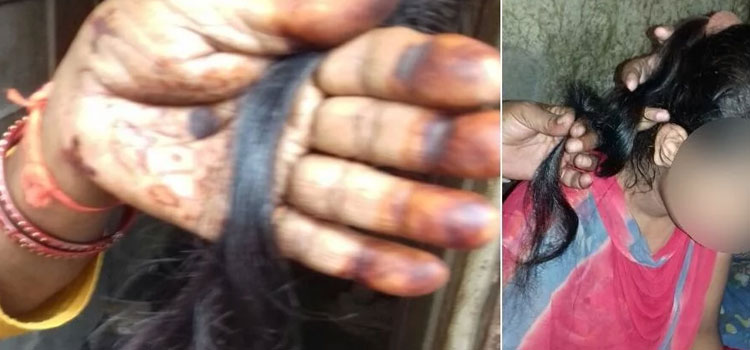 अब 'स्मार्ट सिटी' में चोटी कटी,