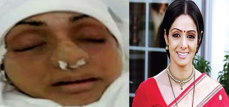 Sridevi
