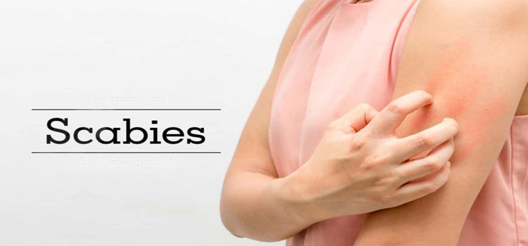Scabies